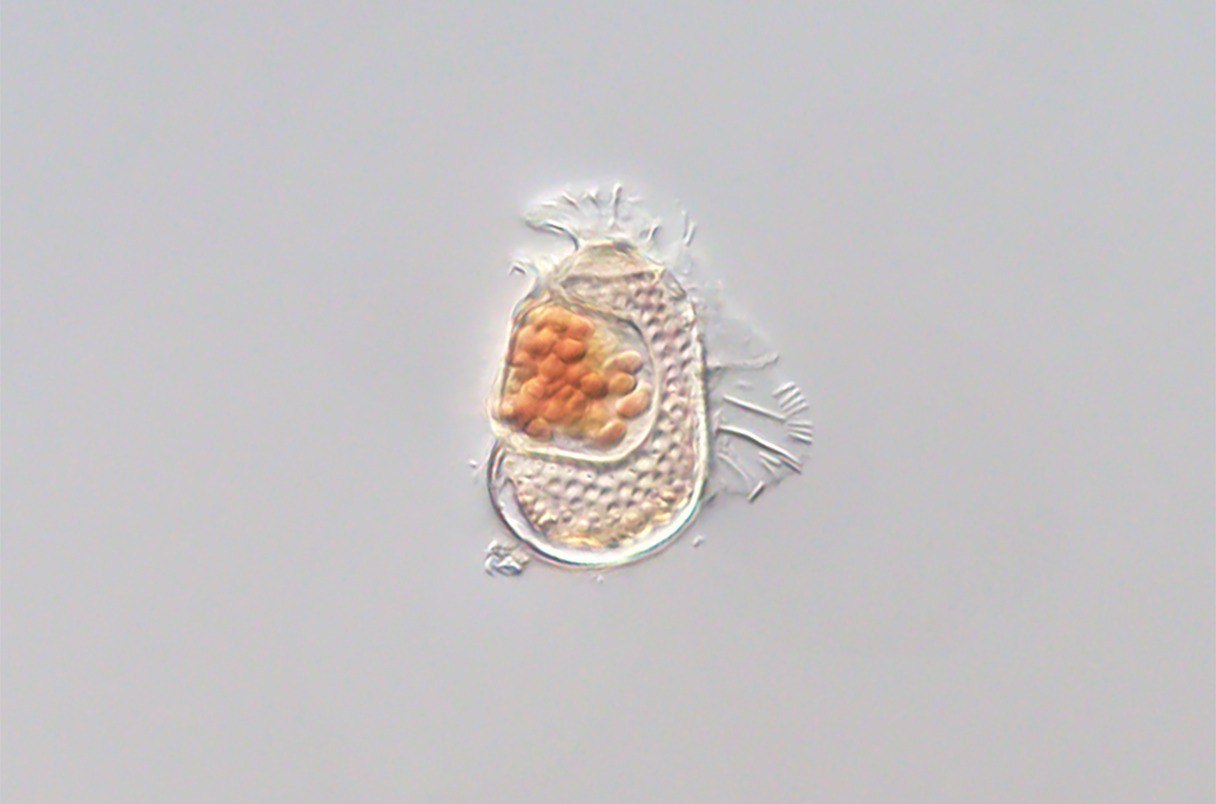 带有奇异基因组的微生物或正演化为病毒